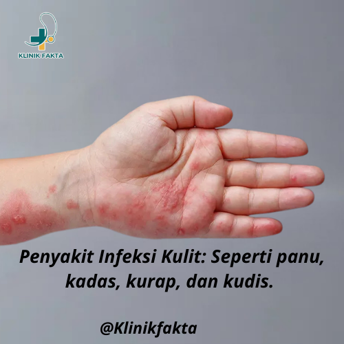 kudis.KlinikFakta_20250813_132701_0048